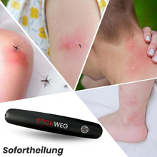 Load image into Gallery viewer, Stichweg - zur effektiven Behandlung von Insektenstichen- und bissen
